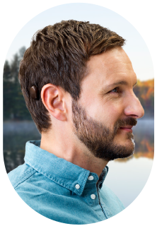 A man wearing bone-anchored hearing aids